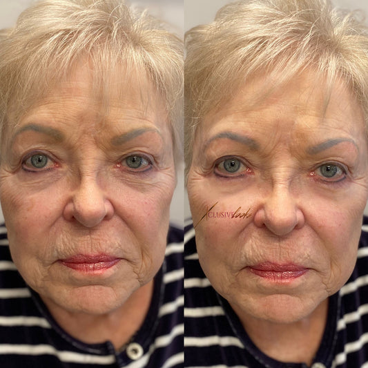 Best Botox Studio in Frisco, Texas